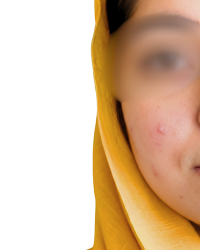 Shaikh Bakhtawer - Before